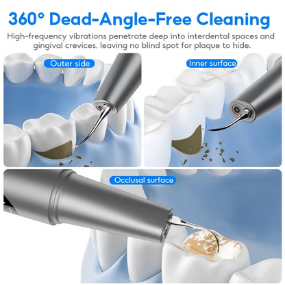 Smiley - Ultrasonic Dental Scaler with 360° Camera *Pre-Order Exclusive Discount*